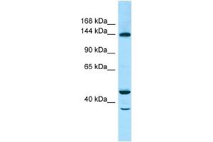 WB Suggested Anti-TBC1D4 Antibody Titration: 1. (TBC1D4 antibody  (C-Term))