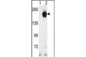 Western blot analysis of GAK (arrow) using GAK Antibody (C-term) (ABIN392633 and ABIN2842139).