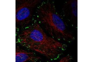 Immunofluorescent staining of HeLa cells with ZYX monoclonal antibody, clone CL2502  (Green) shows distinct focal adhesion. (ZYX antibody)