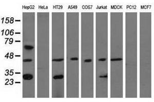 Image no. 2 for anti-Quinolinate Phosphoribosyltransferase (QPRT) antibody (ABIN1500533) (QPRT antibody)
