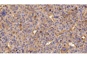 Immunohistochemistry (IHC) image for anti-Epidermal Growth Factor Receptor (EGFR) (AA 888-1210) antibody (ABIN7426025)