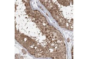 Immunohistochemical staining of human testis with WDR26 polyclonal antibody  shows moderate cytoplasmic and nuclear positivity in cells in seminiferus ducts at 1:50-1:200 dilution.