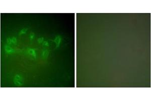 Immunofluorescence analysis of A549 cells, using MDM2 antibody (ABIN5976454). (MDM2 antibody  (C-Term))