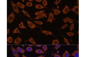 Immunofluorescence analysis of L929 cells using STUB1 Polyclonal Antibody at dilution of 1:100 (40x lens). (STUB1 antibody)