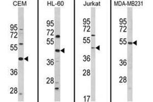 Western blot analysis of PTAR1 Antibody (Center) from left to right in CEM, HL-60, Jurkat, MDA-MB231 cell line lysates (35ug/lane). (PTAR1 antibody  (Middle Region))