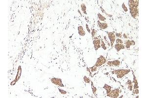 Immunohistochemistry (IHC) image for anti-Wingless-Type MMTV Integration Site Family, Member 3A (WNT3A) (N-Term) antibody (Biotin) (ABIN2477145) (WNT3A antibody  (N-Term) (Biotin))