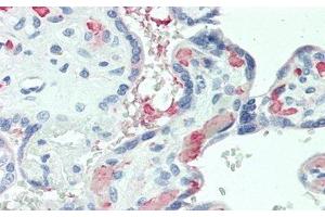 Detection of VEGFB in Human Placenta Tissue using Polyclonal Antibody to Vascular Endothelial Growth Factor B (VEGFB) (VEGFB antibody  (AA 22-207))