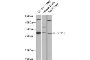 Western blot analysis of extracts of various cell lines, using STX12 antibody (ABIN6128798, ABIN6148655, ABIN6148656 and ABIN6224224) at 1:1000 dilution. (Syntaxin 12 antibody  (AA 1-250))