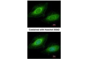 ICC/IF Image Immunofluorescence analysis of methanol-fixed HeLa, using TSSC1, antibody at 1:200 dilution. (TSSC1 antibody  (Center))