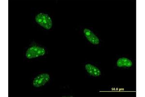 Immunofluorescence of monoclonal antibody to ZFHX3 on HeLa cell. (ZFHX3 antibody  (AA 2811-2910))