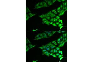 Immunofluorescence analysis of U2OS cells using PSAT1 antibody. (PSAT1 antibody  (AA 1-370))