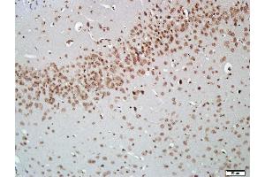 Paraformaldehyde-fixed, paraffin embedded Mouse brain, Antigen retrieval by boiling in sodium citrate buffer (pH6. (AKT2 antibody  (AA 101-200))