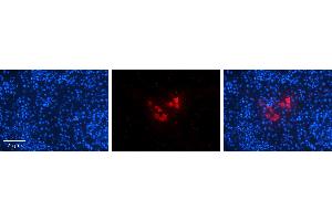 Rabbit Anti-CREBZF Antibody   Formalin Fixed Paraffin Embedded Tissue: Human Testis Tissue Observed Staining: Cytoplasm in Leydig cells Primary Antibody Concentration: N/A Other Working Concentrations: 1:600 Secondary Antibody: Donkey anti-Rabbit-Cy3 Secondary Antibody Concentration: 1:200 Magnification: 20X Exposure Time: 0. (CREBZF antibody  (Middle Region))