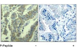 Image no. 1 for anti-Myristoylated Alanine-Rich Protein Kinase C Substrate (MARCKS) (pSer170) antibody (ABIN401558) (MARCKS antibody  (pSer170))