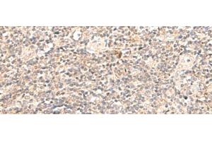 Immunohistochemistry of paraffin-embedded Human tonsil tissue using TRAPPC1 Polyclonal Antibody at dilution of 1:50(x200) (TRAPPC1 antibody)