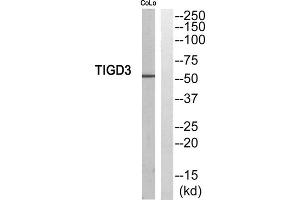 Western blot analysis of extracts from COLO205 cells, using TIGD3 antibody. (TIGD3 antibody  (C-Term))