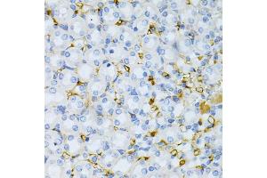 Immunohistochemistry of paraffin-embedded mouse kidney using TAPBP Antibody. (TAPBP antibody)