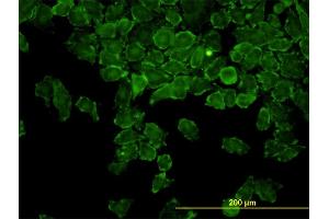 Immunofluorescence of monoclonal antibody to CAP2 on HeLa cell. (CAP2 antibody  (AA 1-477))