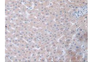 IHC-P analysis of Human Liver Tissue, with DAB staining. (Fibrillin 1 antibody  (AA 723-902))