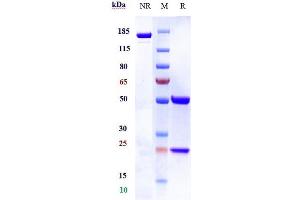 Anti-NKG2D / CD314 Reference Antibody (tesnatilimab) on SDS-PAGE under reducing (R) condition. (Recombinant NKG2D (Tesnatilimab Biosimilar) antibody)