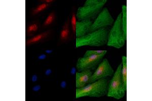 ABIN6258869 and ABIN6273723 staining  cells by IF/ICC. (KLF12 antibody  (Internal Region))