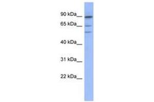Image no. 1 for anti-Tripartite Motif Containing 50 (TRIM50) (AA 395-444) antibody (ABIN6742937) (TRIM50 antibody  (AA 395-444))