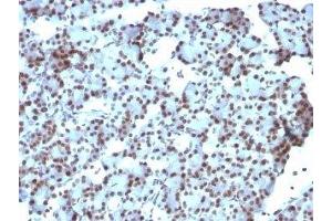 Formalin-fixed, paraffin-embedded rat pancreas stained with SUMO-1 antibody (SUMO1/1188) (SUMO1 antibody)