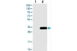 Western blot analysis of Lane 1: Negative control (vector only transfected HEK293T lysate), Lane 2: Over-expression Lysate (Co-expressed with a C-terminal myc-DDK tag (~3. (SLC25A10 antibody)