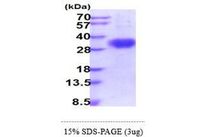 SDS-PAGE (SDS) image for Fc Fragment of IgG, Low Affinity IIIb, Receptor (CD16b) (FCGR3B) (AA 21-200) protein (His tag) (ABIN5855003) (FCGR3B Protein (AA 21-200) (His tag))