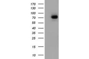 Western Blotting (WB) image for anti-SAM Domain and HD Domain 1 (SAMHD1) antibody (ABIN1500800) (SAMHD1 antibody)