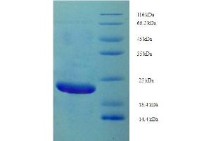 SDS-PAGE (SDS) image for Alopecia, Androgenetic, 2 (AGA2) (AA 19-87) protein (His-SUMO Tag) (ABIN5710900)