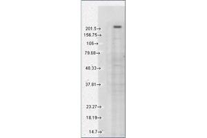 Western Blotting (WB) image for anti-Transient Receptor Potential Cation Channel, Subfamily M, Member 7 (TRPM7) (AA 1817-1863), (C-Term) antibody (ABIN452417) (TRPM7 antibody  (C-Term))