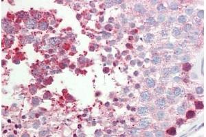 Human Testis: Formalin-Fixed, Paraffin-Embedded (FFPE) (CNGA2 antibody  (AA 190-218))