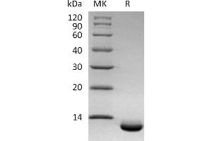 CXCL6 Protein (His tag)