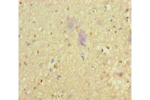Immunohistochemistry of paraffin-embedded human brain tissue using ABIN7161659 at dilution of 1:100 (NMDA Receptor Synaptonuclear Signaling and Neuronal Migration Factor (NSMF) (AA 251-530) antibody)