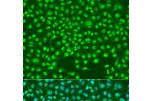 Immunofluorescence analysis of U2OS cells using SKP2 Polyclonal Antibody at dilution of 1:100. (SKP2 antibody)