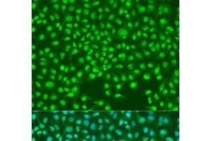Immunofluorescence analysis of U2OS cells using SKP2 Polyclonal Antibody at dilution of 1:100.