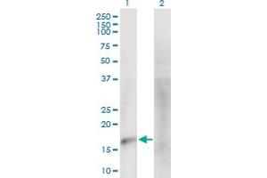Western Blot analysis of MARVELD1 expression in transfected 293T cell line by MARVELD1 MaxPab polyclonal antibody. (MARVELD1 antibody  (AA 1-173))