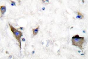 Image no. 1 for anti-PTK2B Protein tyrosine Kinase 2 beta (PTK2B) antibody (ABIN271797) (PTK2B antibody)