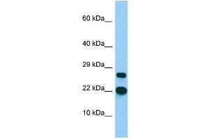 Host: Rabbit Target Name: BTF3L4 Sample Type: MCF7 Whole Cell lysates Antibody Dilution: 1. (BTF3L4 antibody  (C-Term))