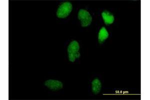 Immunofluorescence of purified MaxPab antibody to LIN9 on HeLa cell. (LIN9 antibody  (AA 1-558))