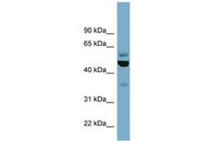Image no. 1 for anti-Tubulin, epsilon 1 (TUBE1) (C-Term) antibody (ABIN6741994) (TUBE1 antibody  (C-Term))