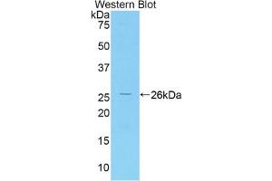 Western blot analysis of the recombinant protein. (IRAK3 antibody  (AA 201-410))