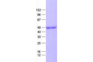 Validation with Western Blot (WDR77 Protein (His tag))