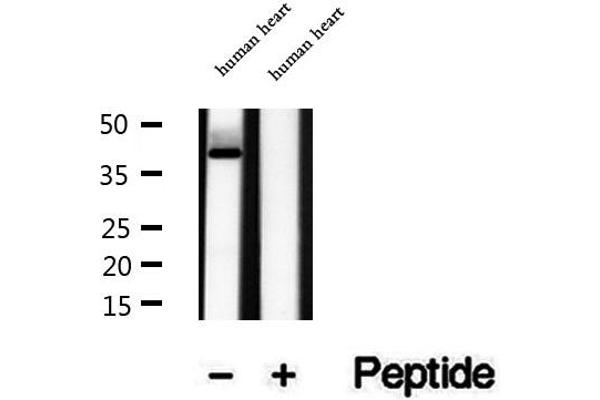 RBM4 antibody  (Internal Region)