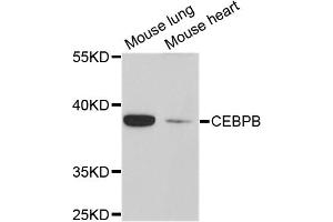Western blot analysis of extracts of various cell lines, using CEBPB antibody (ABIN5997426) at 1/1000 dilution. (CEBPB antibody)