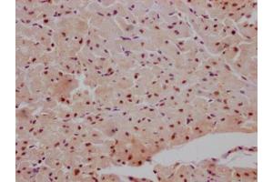 IHC image of ABIN7127610 diluted at 1:100 and staining in paraffin-embedded human heart tissue performed on a Leica BondTM system. (Recombinant MAPKAP Kinase 2 antibody)