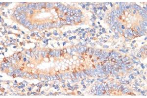 Immunohistochemistry of paraffin-embedded Human appendix using WNK3 Polyclonal Antibody at dilution of 1:100 (40x lens). (WNK3 antibody)