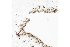 Immunohistochemistry of paraffin-embedded human breast using TOP1 antibody. (Topoisomerase I antibody)