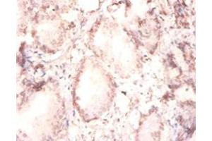 Immunohistochemistry of paraffin-embedded human prostate tissue using ABIN7152800 at dilution of 1:100 (FGF2 antibody  (AA 143-288))